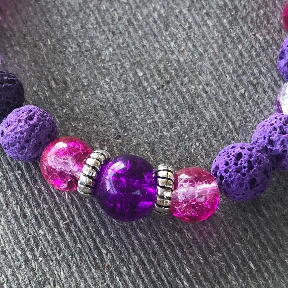 🔥🔥Lava Healing Bracelets - Picture 2 of 6